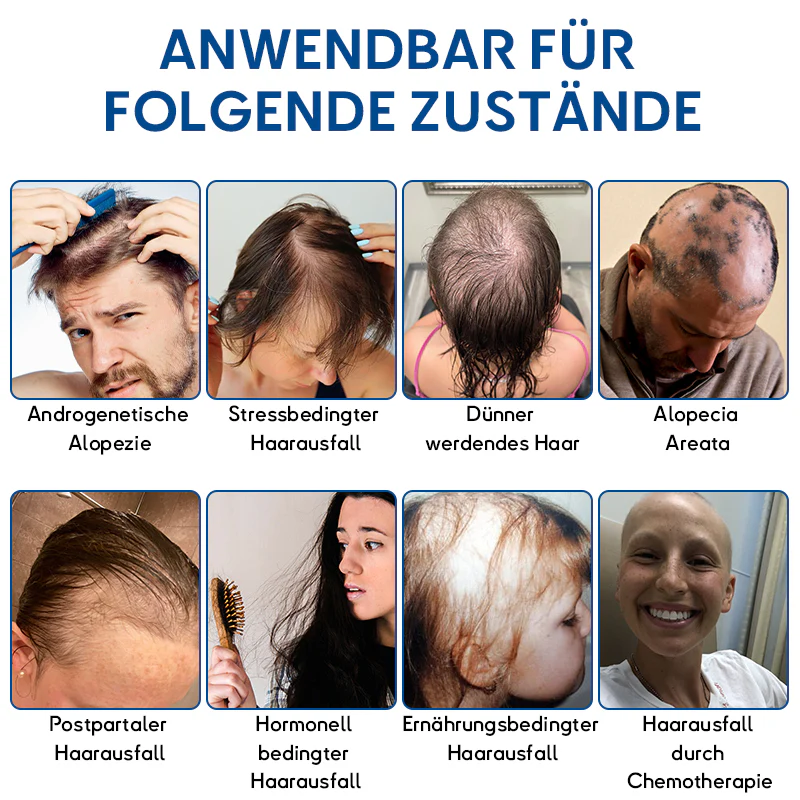 ✅ Offizieller Shop: Flysmus® Stammzellen Haarwachstum Aktiv-Roll-On | Sichtbare Ergebnisse in nur 7 Tagen (🔥BIS ZU 70 % RABATT) - Image 3